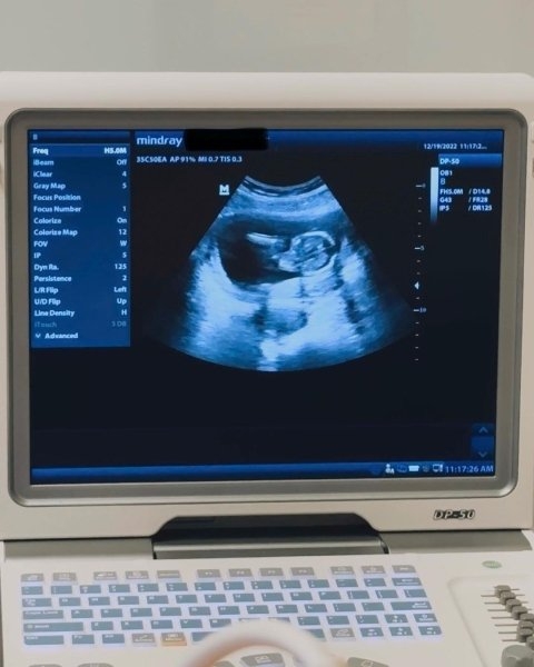 Беременная дочь Алека Болдуина показала фигуру топлес (фото)